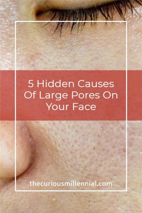 Get Rid Of Pores On Nose, Minimize Pores On Nose, How To Prevent Pores On Face, How To Shrink Pores Naturally, Nose Pores Shrink, Deep Clean Pores Diy Face Masks, How To Reduce Facial Pores, How To Shrink Nose Pores, Clear Pores On Nose