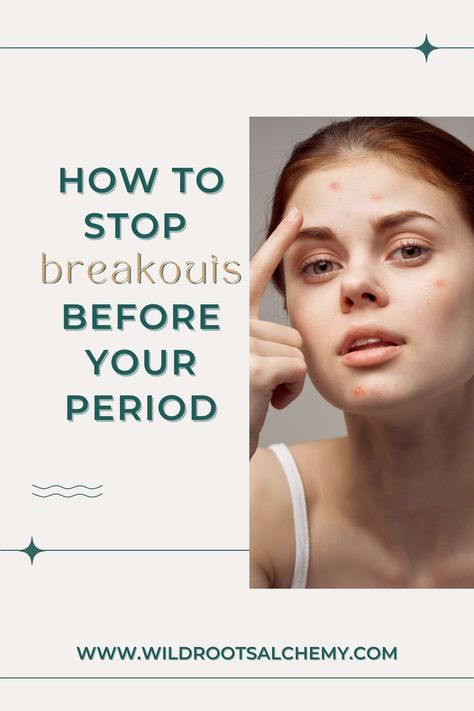 Premenstrual acne, or acne that occurs right before your period, is so common! Here are my top 8 tips for stopping those pre-period breakouts. How To Stop Breakouts, Menstrual Acne, Period Breakouts, How To Avoid Pimples, Period Acne, Period Pimples, How To Stop Pimples, Gelatin Gummies, How To Stop Period