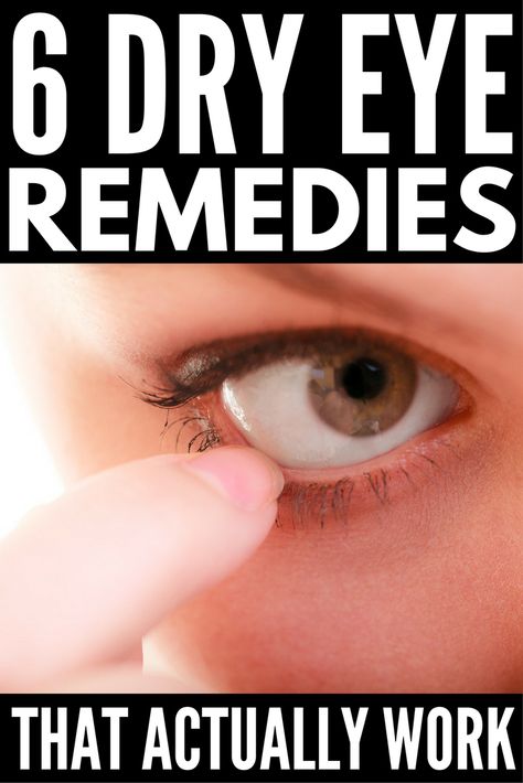 Dry Eye Remedies, Burning Eyes, Blurry Eyes, Dry Eye Symptoms, Dry Eye, Watery Eyes, Eye Exercises, Itchy Eyes, Sore Eyes