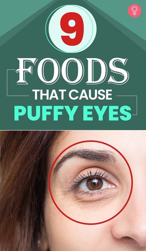 How To Depuff Eyes, Puffy Eyes Remedy, Baggy Eyes, Pimples Overnight, Under Eye Puffiness, How To Get Rid Of Pimples, Beauty Routine Tips, Beauty Natural Products, Dark Circles Under Eyes