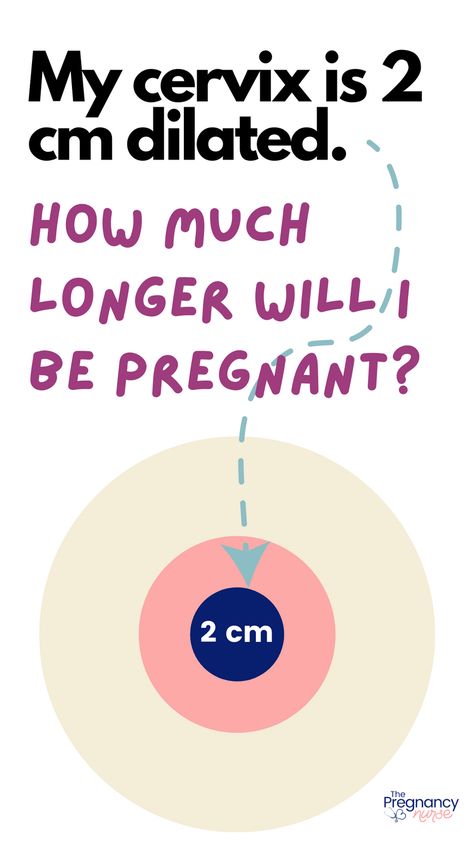Are you feeling the first signs of labor but unsure of how long it'll take? If you're 2 cm dilated, it's time to start preparing for the big event. In this article, we'll break down what it means to be 2 cm dilated, what to expect during the next stages of labor, and how to stay informed and supported throughout your journey. Labour Stages, 2 Cm Dilated, Dilation Chart, Dilation And Effacement, Cervix Dilation, Cervical Dilation, Signs Of Labor, Signs Of Labour, Contractions Labor