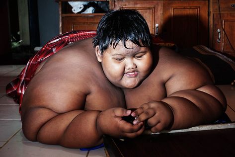 THE WORLD’S fattest boy has been showing off his new trim physique after shedding 17 stone as well as his excess skin. Arya Permana, weighed an eye-watering 30st 3lbs aged just 11, but is now an impressive 13st three years later. The 14-year-old school student had baffled doctors five years ago when pictures of him […] Minecraft Facts, Kissing Video, Indian Funny, Funny Dance, Kissing Scenes, Fat People, Excess Skin, Copyright Music, After Life