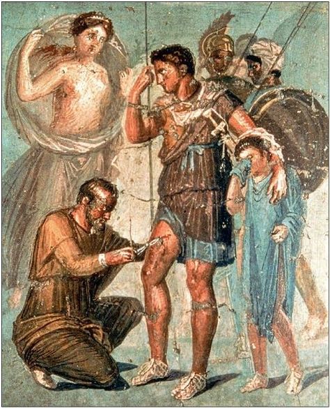 Medicine in Roman Antiquity. Fresco from the “House of Siricus” (VII.1.47) in Pompeii. Depicted is a scene from the poet Virgil in the Aeneid: the injured Trojan Aeneas, accompanied by Menestheus and Achates, leans on the shoulder of his weeping son, Ascanius, while his mother, Aphrodite, looks on and the surgeon Iapix removes an arrowhead from his thigh. Naples Archeological Museum. Roman Painting, Pompeii Italy, Istoria Artei, Pompeii And Herculaneum, Rome Antique, Empire Romain, Ancient Paintings, Julius Caesar, Roman Mythology