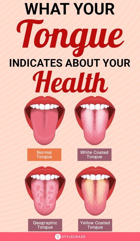 White Coated Tongue, Healthy Tongue, Benefits Of Sports, Tongue Health, Women Health Care, Nail Care Tips, Oral Health Care, Lose 40 Pounds, Good Health Tips