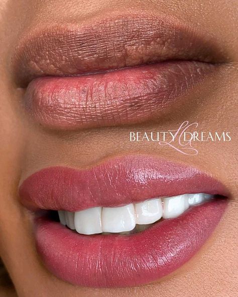 Lip Blushing on Dark Lips: Can Lip Blush Neutralize Dark Lips? Lipblush Before And After, Lip Blushing Before And After, Lipstick For Dark Lips, Lip Blushing Tattoo Colors, Lip Blushing Tattoo Before And After, Lip Hyperpigmentation, Blush Dark Skin, Cosmetic Lip Tattoo, Lip Color Tattoo