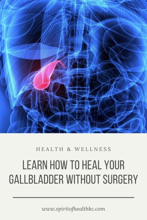 Foods Good For Your Gallbladder, How To Cleanse Your Gallbladder, Holistic Healing Gallbladder, Foods That Help Gallbladder, Meal Plan For Gallbladder Issues, Natural Remedies For Gallbladder, Gallbladder Healthy Foods, Gallbladder Friendly Breakfast, Natural Gallstone Remedy