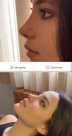 Nose Job Inspiration, Before And After Nose Job, Nose Surgery Rhinoplasty, Rhinoplasty Nose Jobs, Rhinoplasty Before And After, Flot Makeup, Pretty Nose, Job Inspiration, Corps Idéal