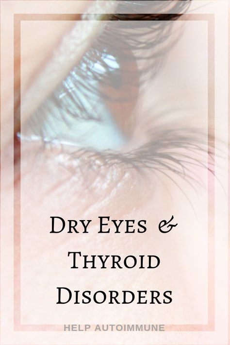 Dry eyes can be related to problems with your thyroid gland.  Sometimes they may be the first sign of #thyroid disease. Goopy Eyes, Low Thyroid, Skin Growths, Eye Infections, Skin Shades, Dry Eye, Thyroid Gland, Eyes Problems, Laser Therapy