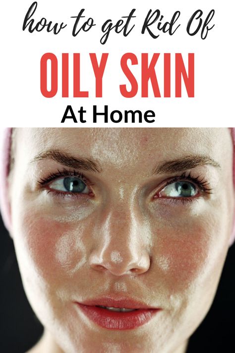 How To Get Rid Oily Skin, How To Treat Oily Skin Faces, Oily Skin Remedy Homemade, How To Control Oil On Face, Mask For Oily Face, Oil Skin Face Mask, Home Remedy For Oily Skin, Natural Remedies For Oily Skin, Oily Face Remedy How To Get Rid Of