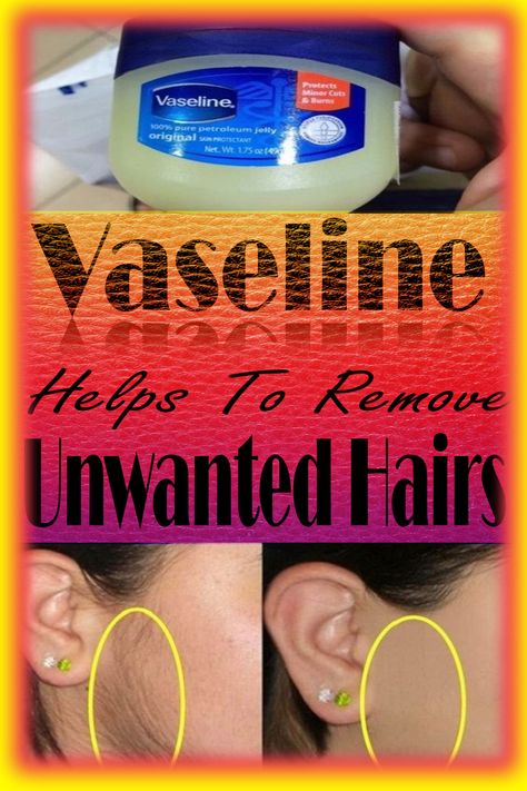 Vaseline Hair Growth, Vaseline Hair Removal, Vaseline Hair, Permanent Hair Removal Cream, Back Hair Removal, Electrolysis Hair Removal, Lip Hair Removal, Unwanted Hair Permanently, Remove Unwanted Facial Hair