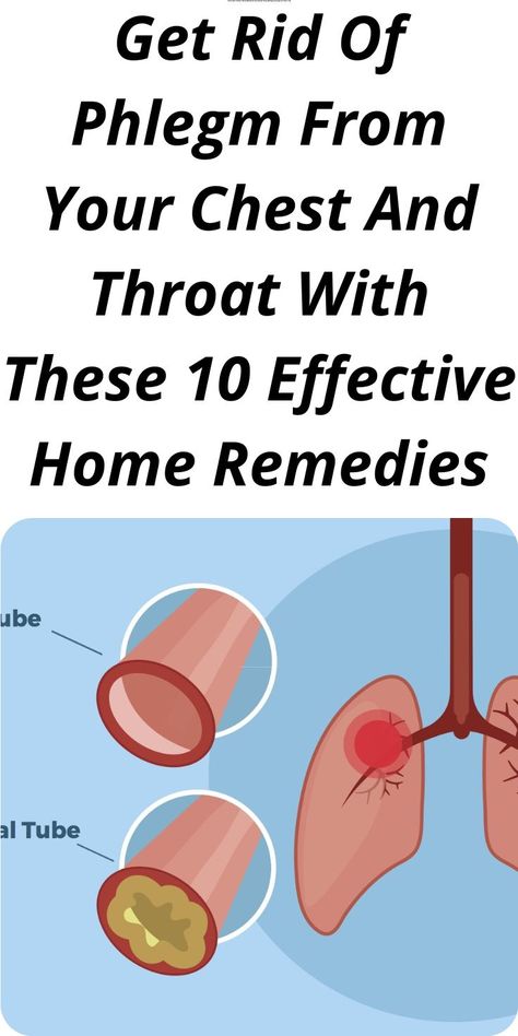 Mucus In Chest, Getting Rid Of Mucus, Chest Congestion Remedies, Congestion Remedies, Getting Rid Of Phlegm, Best Cough Remedy, Sick Remedies, Chest Congestion, Home Remedy For Cough