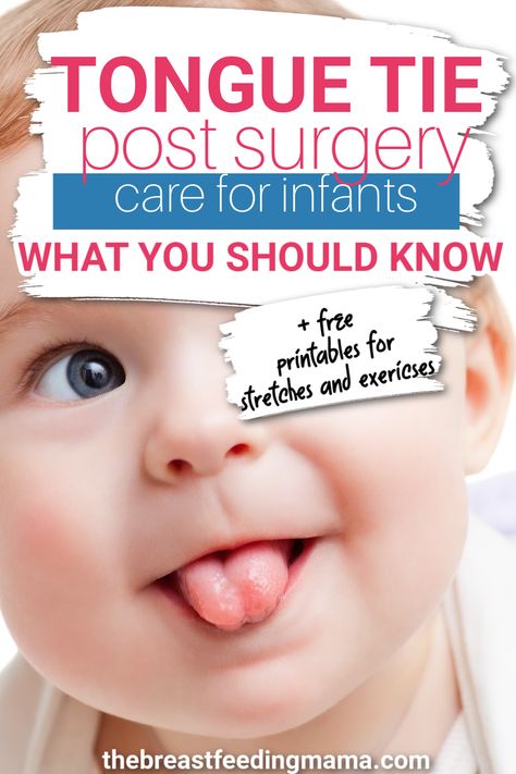 Tongue tie and lipe tie revisions - or frenectomies - are common procedures preformed on infants, primarily to assist with breastfeeding success. However, the after care is essential to proper healing and future success. Here are the best tips for success along with free printables for suck training and post revision exercises. Tongue Tied Baby, Tongue Tie Exercises, Ibclc Exam, Baby Tongue, Growing Sage, Best Pacifiers, Massage Place, Feeding Therapy, Oral Motor