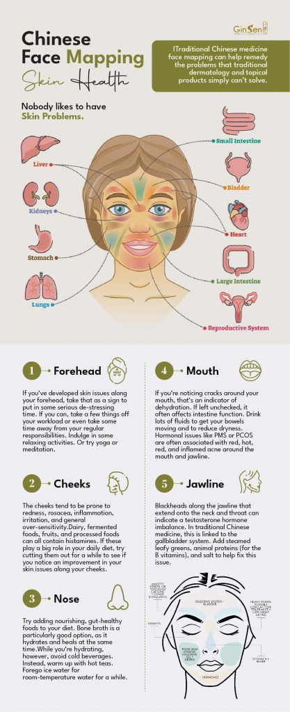 Chinese Facial Mapping, Acne Chart Face Mapping, Chinese Medicine Face Map, Face Mapping Health, Chinese Face Mapping Acne, Face Health Chart, Acne Mapping Face, Chinese Face Mapping, Acne Map