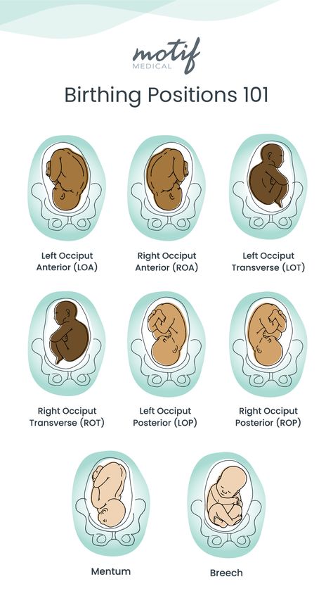 Discover and learn about optimal birthing positions with our midwife in the latest blog! 🤰 Get a FREE birthing chart and valuable tips on locating your baby in your body. Link in bio to learn more about birthing positions before labor. #pregnancytips #motifmedical #labortips #babypositions Doula Vs Midwife, Birth Tips Labour, Epidural Birth Positions, Birth Assistant, Labour Tips, Labour Positions, Birthing Positions, Birth Positions, Doula Website