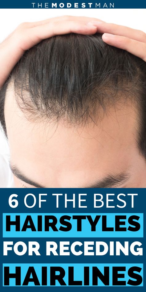 Long Thinning Hair Styles Men, Best Haircut For Receding Hairline Men, Haïr Style For Men, Men’s Short Hairstyles Receding Hairline, Hairstyles For Receding Hairline For Men, Men Haircut For Big Forehead, Men’s Hair Cuts For Receding Hairline, Men Receding Hairline Hairstyles, Hairstyle For Big Forehead Mens