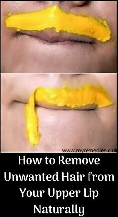 How to Remove Unwanted Hair from Your Upper Lip Naturally... how to stop hair growth on upper lip naturally upper lip hair removal at home naturally permanently how to remove upper lip hair at home immediately how to remove mustache for girl naturally and permanently best upper lip hair removal method how to remove upper lip hair in 5 minutes how to remove upper lip hair with sugar and lemon hair on upper lip female.... Chin Hair Removal, Upper Lip Hair Removal, Back Hair Removal, Best Facial Hair Removal, Hair Remove, Lip Hair Removal, Face Hair Removal, Upper Lip Hair, Ingrown Hair Removal