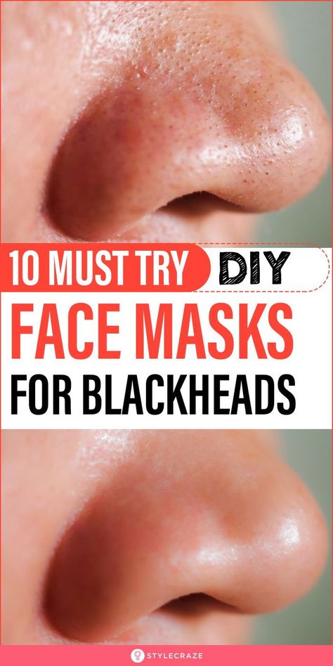 Removing Blackheads, Chin Acne, Black Head Remover Mask, Face Mask For Blackheads, Blackhead Mask, Unwanted Hair Growth, Make Up Palette, Natural Acne Remedies, Glow Skin