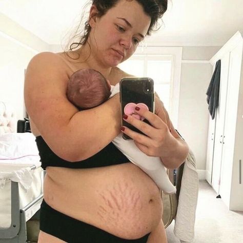 Postpartum Tummy, Raw Images, Postpartum Belly, Post Baby Body, Stretch Mark Removal, Throwing It Back, Postpartum Body, After Giving Birth, Baby Weight