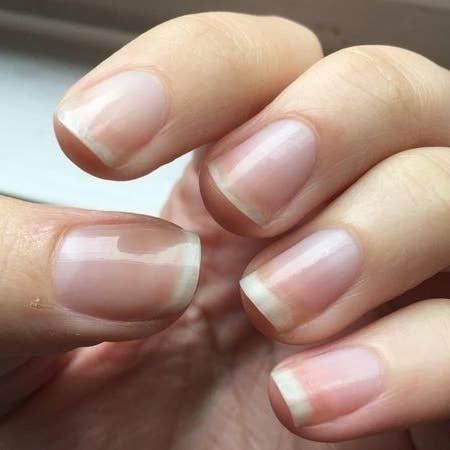 Nails Shiny, Grow Nails Faster, Nail Growth, How To Grow Nails, Nail Fungus, Strong Nails, Nail Health, Healthy Nails, Perfect Nails