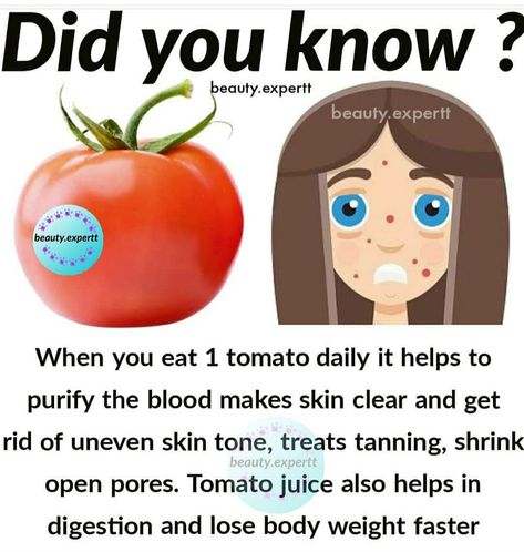 How To Clear Open Pores On Face, Open Pores On Face, Tomato Benefits, Pores On Face, Skin Challenge, Skin Facts, Open Pores, Clear Healthy Skin, Natural Skin Care Remedies