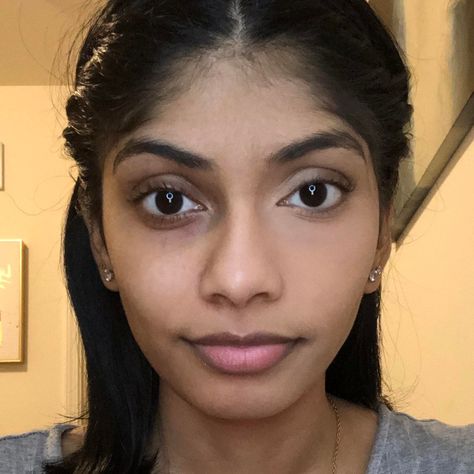 Woman Shares Amazing Undereye Concealer Before-and-After Photo on Reddit | Allure Reduce Pimple Redness, Undereye Concealer, Natural Makeup For Teens, Maybelline Concealer, Maybelline Fit Me Concealer, Eye Wrinkles, Homemade Face Cream, Face Creams, Lush Products