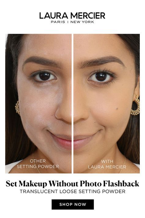 No need to worry about flashback! Laura Mercier's setting powder will make you camera-ready and set makeup for all-day wear with a 16-hour matte finish. Brown Spots On Hands, Brown Age Spots, Brown Spots On Skin, Loose Setting Powder, Brown Spots Removal, Brown Spots On Face, Skin Spots, Dark Under Eye, Spots On Face