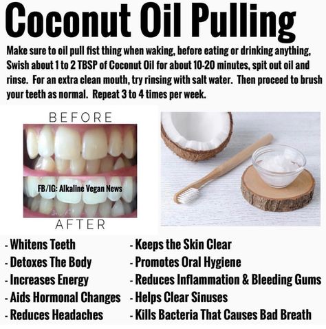 Use coconut oil BEFORE brushing your teeth for these incredible health benefits. Benefits Of Coconut, Coconut Oil For Teeth, Holistic Health Remedies, Coconut Oil Pulling, Teeth Health, Oil Pulling, Benefits Of Coconut Oil, Natural Health Remedies, Health Facts