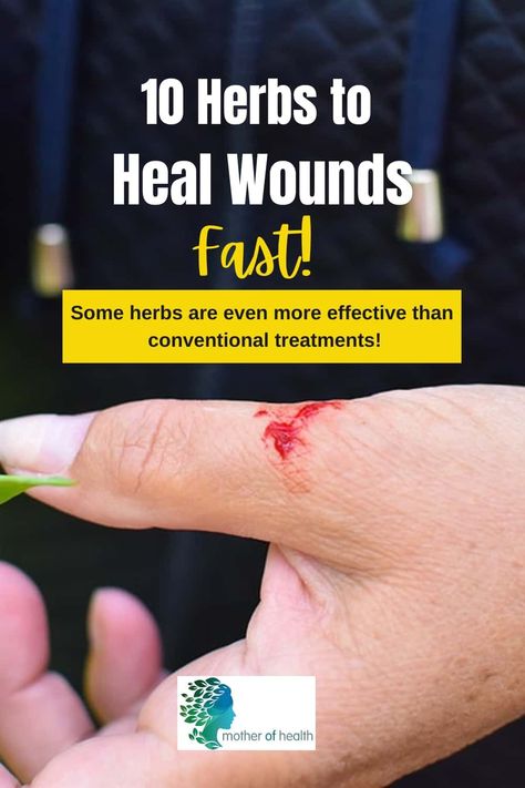 When it comes to healing wounds, nature has provided us with an abundance of herbs that can help. Here are 10 herbs to heal wounds fast and includes tips on how to use them. Nature, Herbs To Heal, Heal Wounds Faster, Healing Wounds, Holistic Health Remedies, Holistic Health Coach, Holistic Remedies, Wound Healing, Health Inspiration