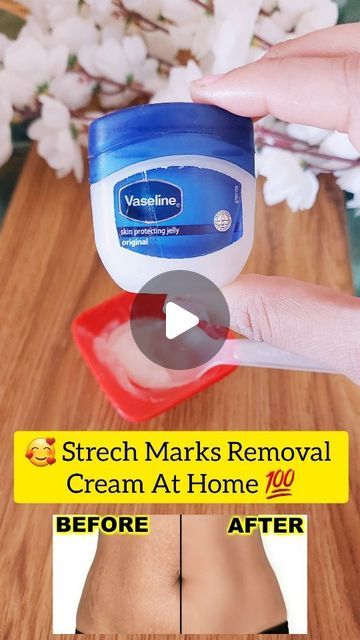 Strech Marks Remedies, Strech Marks Removal, Belly Blaster, Strech Marks, Diy Cream, Underarm Hair Removal, Liver Detoxification, A Pill, Long Hair Wedding Styles