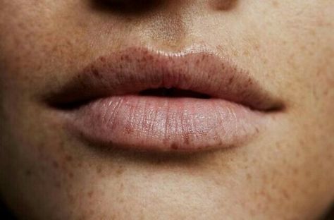 Photo Lip Freckles, Trevelyan Aesthetic, Grimm Aesthetic, Demeter Aesthetic, Freckles Aesthetic, Peggy Schuyler, Lips Aesthetic, Lego Poster, Cupid's Bow