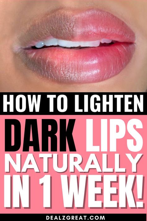 7 Home Remedies To Get Rid Of Dark Lips At Home! Lip Hyperpigmentation, Darkness Around Mouth, Pigmentation Remedy, Get Rid Of Dark Lips, Lighten Dark Lips, Remedies For Dark Lips, Removing Hyperpigmentation, Lip Lightening, Lip Tips