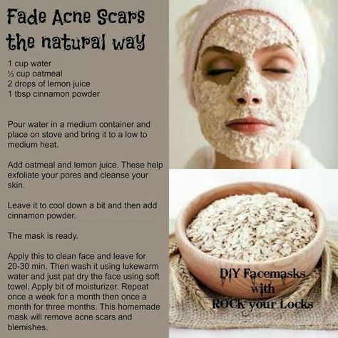 naturally fade acne scars diy how to diy beauty tutorials diy scrubs beauty tips beauty remedies acne scars diy face scrub Obličejové Masky, Diy Acne, Home Remedies For Acne, Acne Scar Removal, Cystic Acne, Remove Acne, Beauty Remedies, Acne Remedies, Skin Remedies