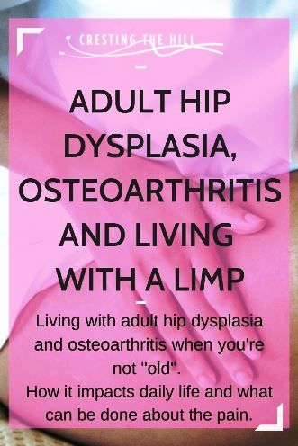 Hip Problems In Women, Hip Dysplasia In Women, Hip Displaysia, Dupuytren's Contracture, Hip Pain Relief, Essential Oils For Pregnancy, Hip Exercises, Hip Problems, Hip Surgery