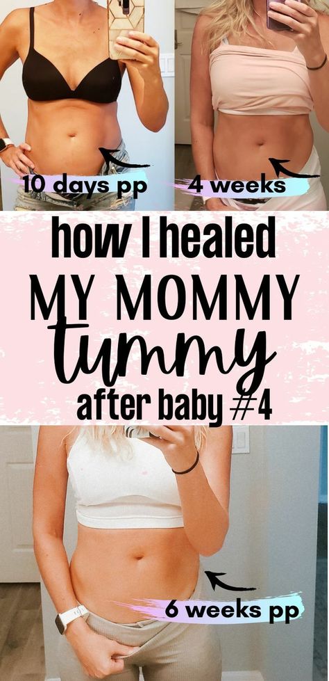 Mommy Tummy Before And After, Post Partum Belly Workout, Post Partum Checklist, After Pregnancy Belly, After Pregnancy Body, Post Partum Belly, Belly After Pregnancy, Belly After Baby, Post Partum Recovery