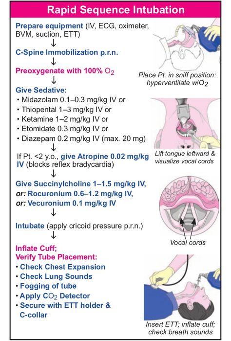 Rapid Sequence Intubation Paramedic Notes, Paramedic Student, Nurse Anesthesia, Drawing Marvel, Nurse Tips, Paramedic School, Nursing Cheat, Flight Nurse, Medicine Studies