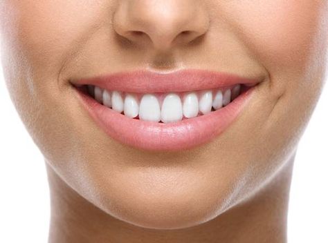 DIY Teeth Whitening: Smile Brilliant Review [Updated 2021] Natural Teeth Whitening, Make Teeth Whiter, Laser Whitening, Teeth Whitening Diy, Diy Teething, Teeth Whitening System, Dental Veneers, Smile Design, Sensitive Teeth