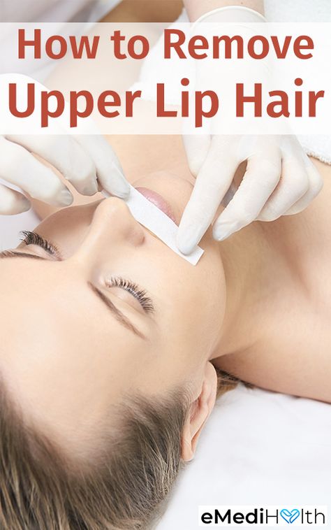 Removing upper lip hair at home is a common practice and can be performed in various ways. Always conduct a patch test before trying a new method of removing upper lip hair. Here are some common hair removal methods that you can try at home. Remove Upper Lip Hair, Waxing Vs Shaving, Natural Hair Removal Remedies, Upper Lip Hair Removal, Hair Removal At Home, Lip Hair Removal, Upper Lip Hair, At Home Hair Removal, Unwanted Facial Hair