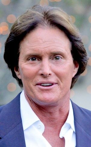 Bruce Jenner Before and after Photos Caitlyn Jenner Before And After, Bruce Jenner, Hairstyle Names, Caitlyn Jenner, Jenner Family, Cosmetic Procedures, Bruce Wayne, After Photos, Kardashian Jenner