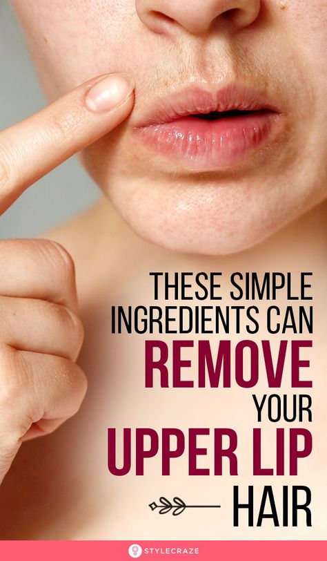 How To Remove Hair From Upper Lip, Removing Upper Lip Hair, Natural Upper Lip Hair Removal, How To Naturally Remove Facial Hair, Hair On Face Removal, Get Rid Of Upper Lip Hair, Mustache Removal For Women, Uper Lips Hair Remover At Home, Beauty Tips For Face At Home