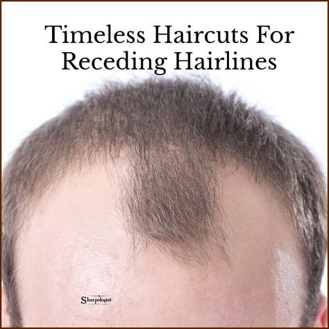 Men’s Receding Hairline Haircuts, Mens Haircuts Short Receding Hairline, Haircuts For Men Receding Hairline, Short Hair Men Receding Hairline, Haircuts For Bad Hairline, Men’s Haircut With Receding Hairline, Receded Hairline Styles Men, Haircut For Men Receding Hairline, Mens Thinning Hairstyles Short