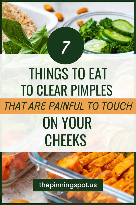 Wondering what toeat for clear skin. Here are 7 foods good for skin. Tese foods get rid of acne super fast from the inside. They are foods I eat for pimple free skin. If you want to learn how to get rid of pimples on cheeks, forehead, that arepainful, read more what to eat for clear skin | foods good for skin | foods to get rid of acne | meals good for acne prone skin | acne friendly meals | foods for pimple fre skin | pimple clearing | ow to get rid of pimples | clear painful pimples on cheeks