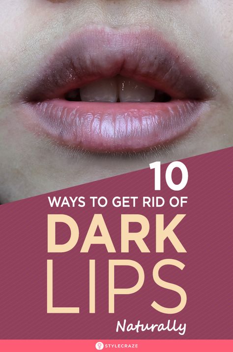 Get Rid Of Dark Lips, Watermelon Lip Scrub, Remedies For Dark Lips, Honey Lip Scrub, Lip Lightening, Natural Lip Scrub, Throbbing Headache, Lip Scrub Recipe, Lip Scrub Homemade