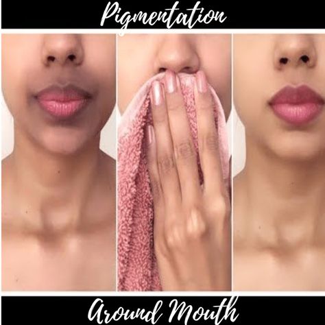 https://www.glossypolish.com/causes-remedies-skin-pigmentation-around-mouth/ , #darkskinaroundthemouth #SkinPigmentation Lighten Skin, Hyperpigmentation Around Mouth, Lip Hyperpigmentation, Dark Skin Around Mouth, Pigmentation Remedy, Removing Hyperpigmentation, Get Rid Of Hyperpigmentation, Pigmented Lips, Beauty Tips For Glowing Skin