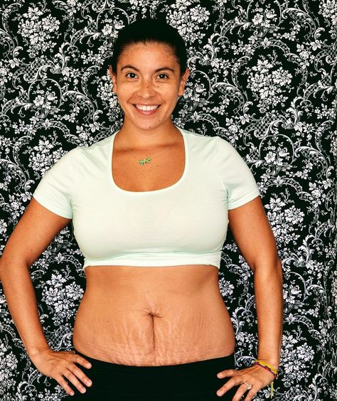 Body Transformations, Real Postpartum Bodies, Postpartum Bodies, Transformation Du Corps, Post Pregnancy Body, Feminist Artist, Extra Skin, Postpartum Body, Positive Body Image