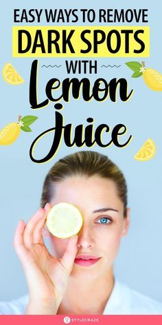 How To Use Lemon To Lighten Skin, Lemon Remedies For Skin, How To Treat Dark Spots On Face, Darkspots Skincare Home Remedy, How To Remove Spots On Face, Natural Dark Spot Remover For Face, Dark Spots On Legs Remove Diy, Vitamin C For Dark Spots, How To Remove Spots From Face