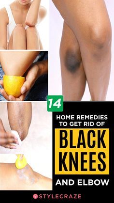 How To Lighten Knees, Dark Knees, Teknik Makeup, Dark Elbows, Healthy Woman, Make Up Foundation, Lifting Facial, Skin Face Mask, Dark Underarms