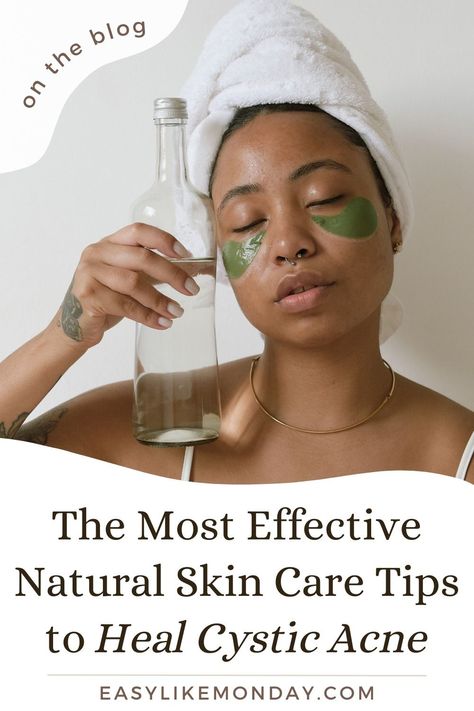 The Most Effective Natural Skin Care Tips to Heal Cystic Acne Fast Heal Acne Naturally, Remedies For Hormonal Acne, Get Rid Of Cystic Acne, How To Balance Hormones, Acne Home Remedies, Cystic Acne Remedies, Back Acne Remedies, Clear Skin Fast, Face Mapping Acne