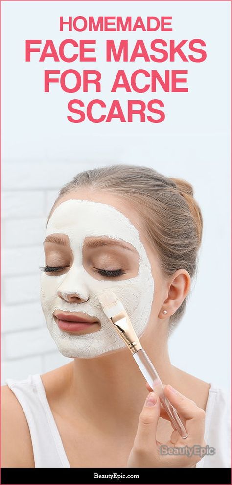 Potato Face Mask, Face Masks For Acne, Masks For Acne, Acne Scar Diy, Yogurt Face Mask, Acne Scar Mask, Lemon Face Mask, Turmeric Face Mask, Honey Face Mask