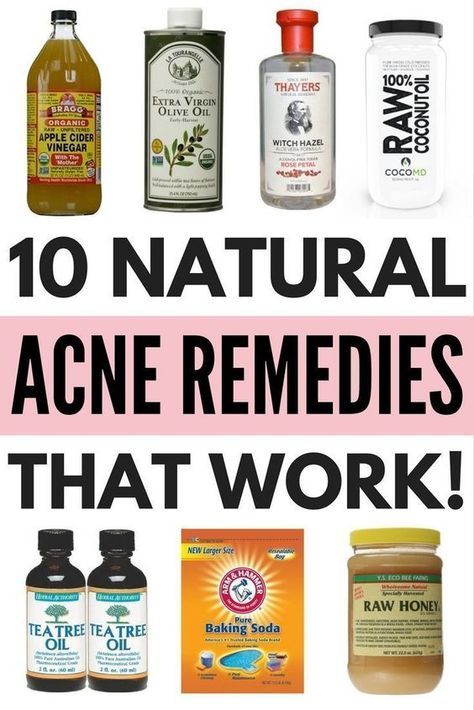 Honey Baking, Beauty Blogs, Coconut Oil For Acne, Skin Care Routine For 20s, Get Rid Of Acne, Diy Acne, Rid Of Acne, Natural Acne, Natural Acne Remedies