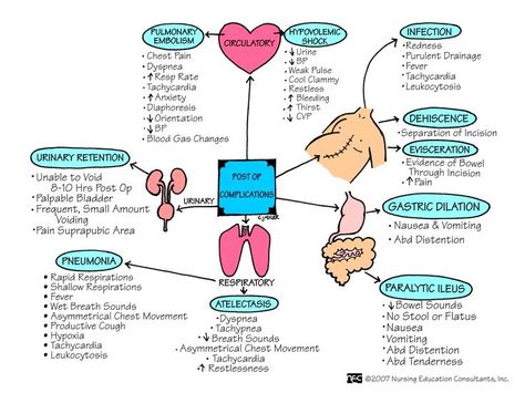 Do you plan on going to PACU when you're out of nursing school? This offers up a great visual on the responsibilities you may face being a PACU nurse.  Follow @nurselinds for more great tips and tools!  Thanks work.chron.com for original post. Parish Nurse, Med Surge, Nurses Notes, Nursing Tools, Nclex Tips, Perioperative Nursing, Ems Training, Nursing Information, Nursing Fun